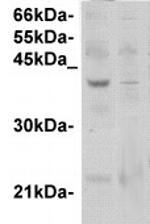 GPCR119 Antibody in Western Blot (WB)