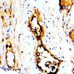 L-Plastin Antibody in Immunohistochemistry (Paraffin) (IHC (P))