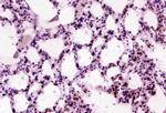 Tenascin C Antibody in Immunohistochemistry (Paraffin) (IHC (P))