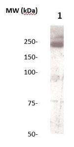 Tenascin C Antibody in Western Blot (WB)