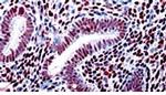 EWSR Antibody in Immunohistochemistry (Paraffin) (IHC (P))