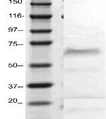 Selectin E Antibody in Western Blot (WB)