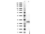 RFP Polyclonal Antibody