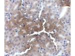 AP2M1 Antibody in Immunohistochemistry (Paraffin) (IHC (P))