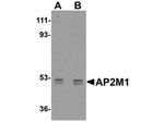AP2M1 Antibody in Western Blot (WB)