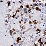 CD117 (c-kit) Antibody in Immunohistochemistry (Paraffin) (IHC (P))