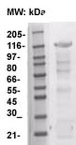 CD117 (c-kit) Antibody in Western Blot (WB)