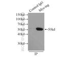 MYC tag Antibody in Immunoprecipitation (IP)