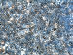 CD2 Antibody in Immunohistochemistry (Paraffin) (IHC (P))