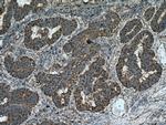 GRP94 Antibody in Immunohistochemistry (Paraffin) (IHC (P))
