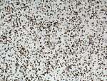TDP-43 Antibody in Immunohistochemistry (Paraffin) (IHC (P))