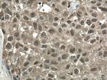 S100A11 Antibody in Immunohistochemistry (Paraffin) (IHC (P))
