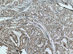 S100A11 Antibody in Immunohistochemistry (Paraffin) (IHC (P))