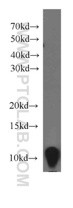 S100A11 Antibody in Western Blot (WB)