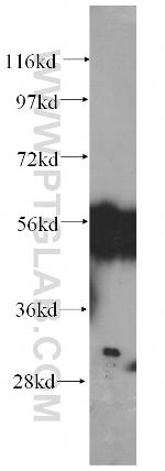 FKBPL Antibody in Western Blot (WB)