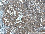 DSE Antibody in Immunohistochemistry (Paraffin) (IHC (P))
