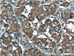 DSE Antibody in Immunohistochemistry (Paraffin) (IHC (P))