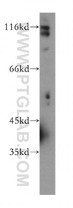 DSE Antibody in Western Blot (WB)