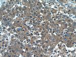Transgelin 2 Antibody in Immunohistochemistry (Paraffin) (IHC (P))