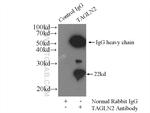 Transgelin 2 Antibody in Immunoprecipitation (IP)