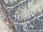Transgelin 2 Antibody in Immunohistochemistry (Paraffin) (IHC (P))