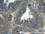 Transgelin 2 Antibody in Immunohistochemistry (Paraffin) (IHC (P))