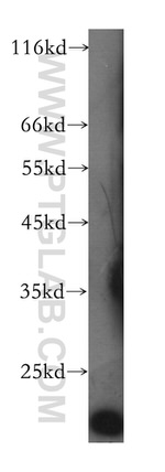 Transgelin 2 Antibody in Western Blot (WB)