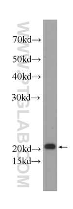 Transgelin 2 Antibody in Western Blot (WB)
