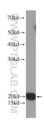 Transgelin 2 Antibody in Western Blot (WB)
