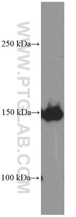 PDGFRA Antibody in Western Blot (WB)
