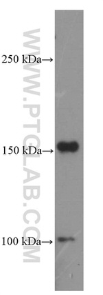 PDGFRA Antibody in Western Blot (WB)