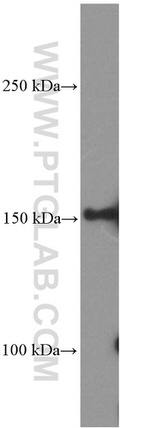 PDGFRA Antibody in Western Blot (WB)