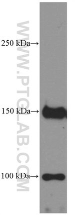 PDGFRA Antibody in Western Blot (WB)