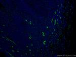 ACKR2 Antibody in Immunohistochemistry (PFA fixed) (IHC (PFA))