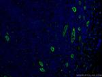 ACKR2 Antibody in Immunohistochemistry (PFA fixed) (IHC (PFA))