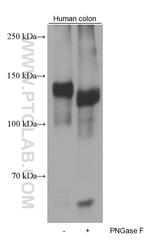 EMILIN1 Antibody in Western Blot (WB)