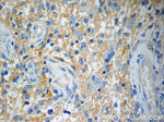 Annexin A2 Antibody in Immunohistochemistry (Paraffin) (IHC (P))