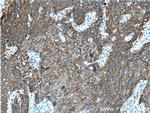 MAGEA3 Antibody in Immunohistochemistry (Paraffin) (IHC (P))