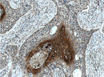 MAGEA3 Antibody in Immunohistochemistry (Paraffin) (IHC (P))