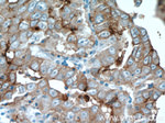 MAGEA3 Antibody in Immunohistochemistry (Paraffin) (IHC (P))