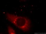 PLOD3 Antibody in Immunocytochemistry (ICC/IF)