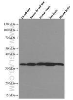 Syntaxin 6 Antibody in Western Blot (WB)