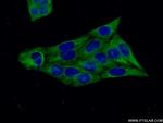 ATG5 Antibody in Immunocytochemistry (ICC/IF)