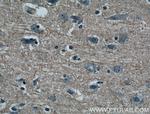 GMF-beta Antibody in Immunohistochemistry (Paraffin) (IHC (P))