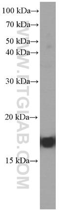GMF-beta Antibody in Western Blot (WB)
