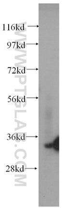 Stanniocalcin 2 Antibody in Western Blot (WB)