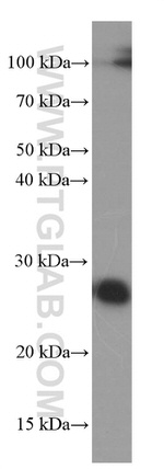 ERAB Antibody in Western Blot (WB)