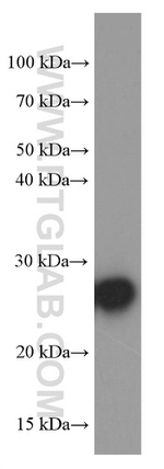 ERAB Antibody in Western Blot (WB)