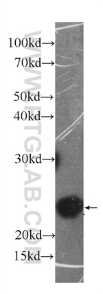 IL18 Antibody in Western Blot (WB)