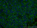 RRM1 Antibody in Immunohistochemistry (PFA fixed) (IHC (PFA))